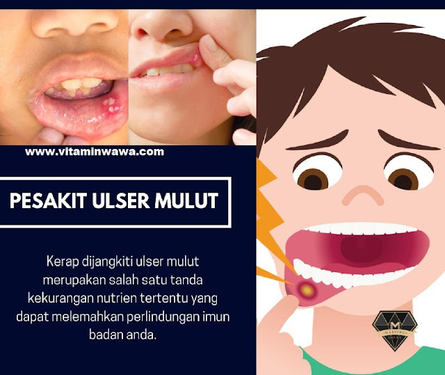 vitamin untuk kecergasan badan vitamin untuk tenaga di farmasi suplemen untuk tenaga shaklee vitamin untuk kecergasan badan lelaki vitamin untuk badan letih lesu set tenaga premium shaklee, set tenaga shaklee, set kecergasan tenaga shaklee, Nutrien untuk tenaga shaklee, nutrisi shaklee untuk tenaga, vitamin shaklee untuk tenga, vitamin untuk kecergasan badan suplemen untuk tenaga shaklee supplement tambah tenaga vitamin untuk tenaga di farmasi vitamin untuk kecergasan badan suplemen untuk tenaga shaklee supplement tambah tenaga vitamin untuk tenaga di farmasi