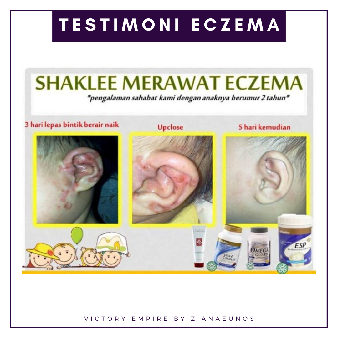 Testimoni Set Eczema Shaklee