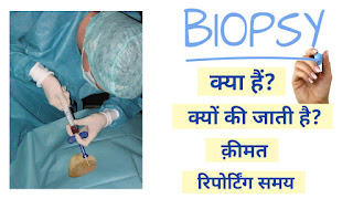 Biopsy meaning in hindi, biopsy, biopsy test,