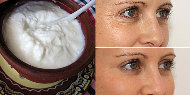 It is called miracle cream removes stains and wrinkles from your face results from the first application