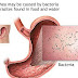 What is Diarrhea? What are the types?  Instant treatment at home.
