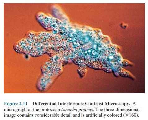 Differential interference contrast microscopy
