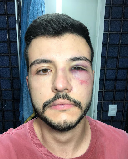 Matheus Ribeiro foi agredido durante tentativa de assalto em Brasília