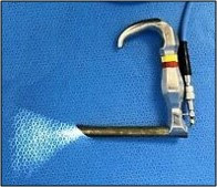 Holiger anterior commissure laryngoscope