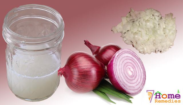 Onion juice for natural hair growth