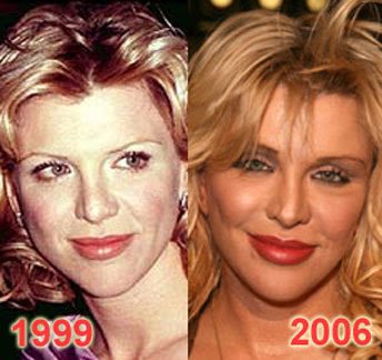 Courtney Love lip injections? (image hosted by plasticsurgerycelebrity.com)