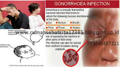 Apa Penyakit Kelamin Gonore Bisa Sembuh Sendiri