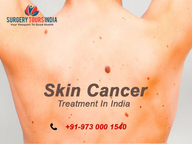  Skin cancer treatment 