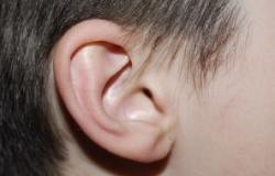 Hearing Problems