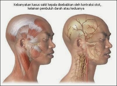 Askep-Penyakit-Kepala