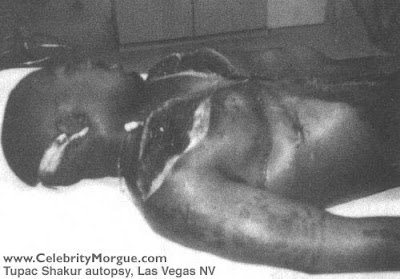 Celebrity Death Photos on Above  Tupac Shakur Autopsy Photo