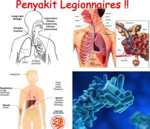 Penyakit Legionnaries