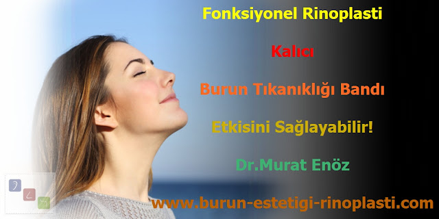 Burun tıkanıklığı bandı - Burun tıkanıklığı tedavisi - Fonskiyonel rinoplasti - Burun tıkanıklığı nedenleri - Burun tıkanıklığı ameliyatı - Burun tıkanıklığı için tedavi - Burun tıkanıklığı çözüm