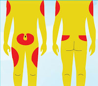 BAHAGIAN SUNTIKAN INSULIN