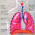 prognosis mesothelioma