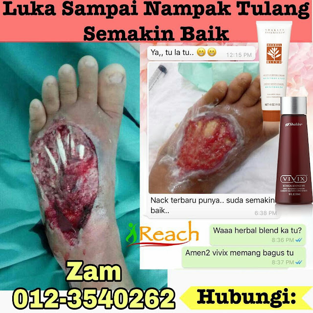 Pengedar Shaklee Bandar Jengka, Jerantut, Temerloh dan seluruh Malaysia