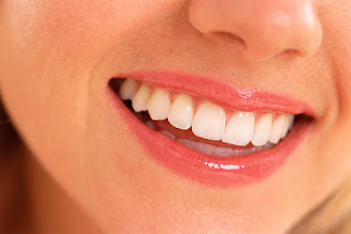 Miami teeth whitening