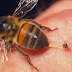 لسعة النحل تقرص مرض السرطان في الصين