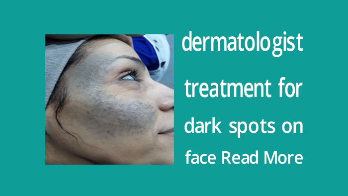 dermatologist-treatment-for-dark-spots-on-face