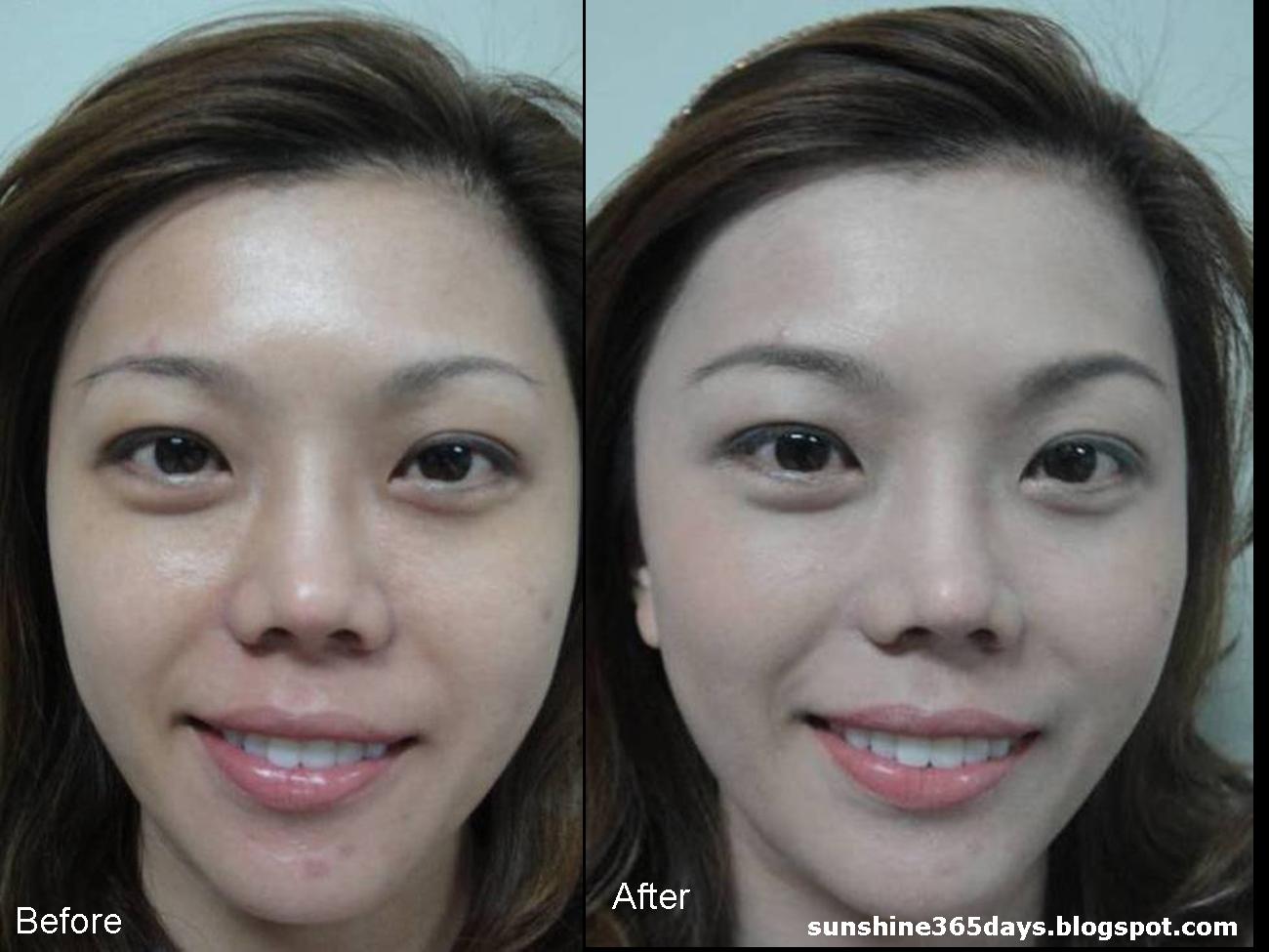 BB Cream Before and After