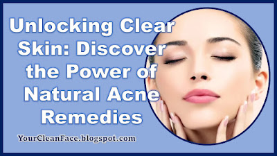 Unlocking Clear Skin: Discover the Power of Natural Acne Remedies