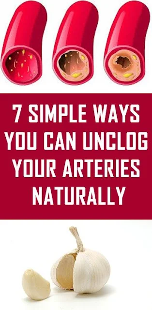 7 Simple Ways to Unclog Your Arteries Naturally