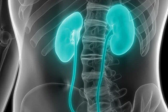 Kidney failure