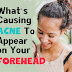 What's Causing Acne To Appear on Your Forehead?