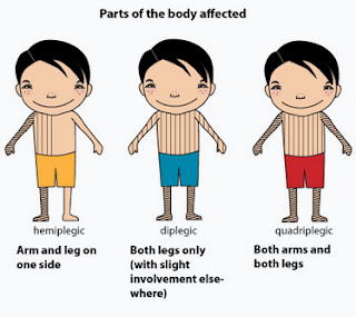 Exams and Tests of Cerebral Palsy