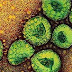 CDC mengesahkan kes pertama virus MERS (MIDDLE EAST RESPIRATORY SYNDROME CORONAVIRUS (MERS-COV)  adalah dari Amerika