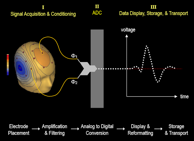 https://www.quora.com/Electroencephalography/How-are-brain-waves-read/answer/Edward-Claro-Mader