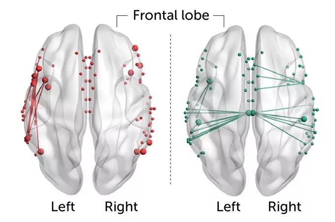 How Language Shapes the Wiring of Our Brain