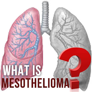 What is mesothelioma?