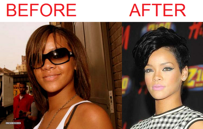 Rihanna Skin Bleaching