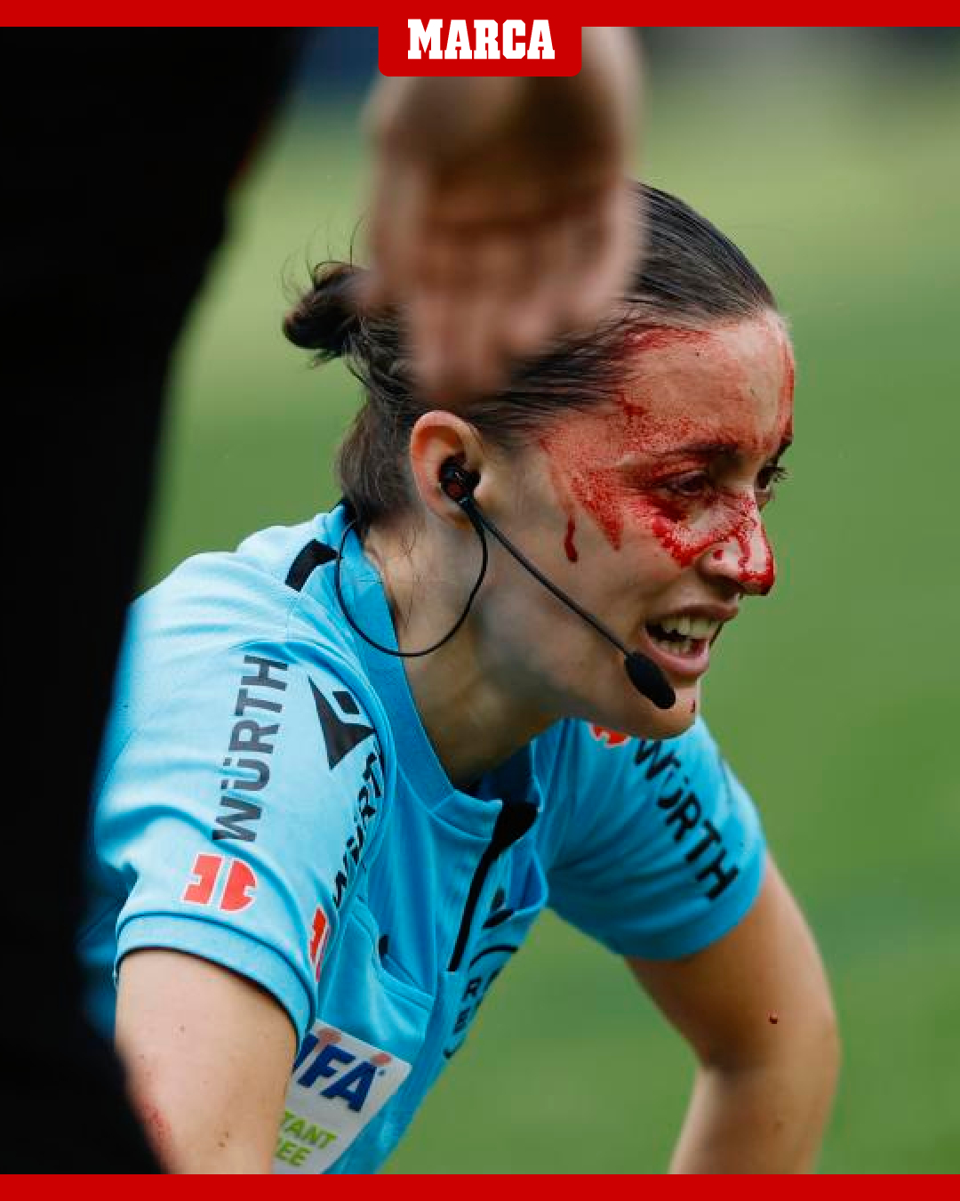 Lineswoman Guadalupe Porras left covered in blood after being hit by a CAMERA