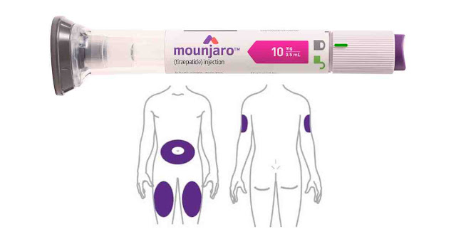 Best Place to Inject Mounjaro