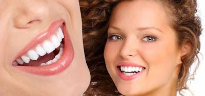 Trồng răng giả mất thời gian bao lâu theo quy trình chuẩn Quốc tế 