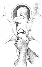 clip_image002[24]