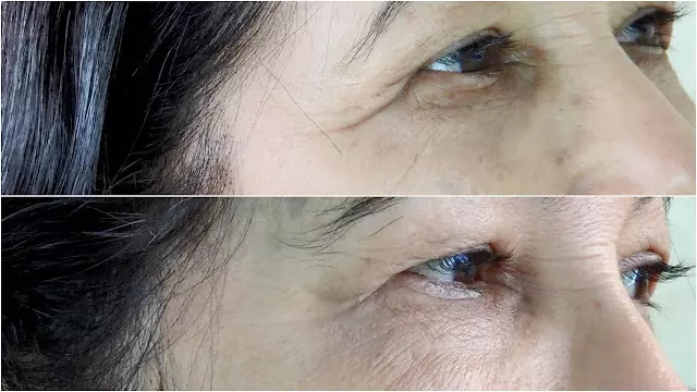 Testando anti-rugas Instantly Ageless