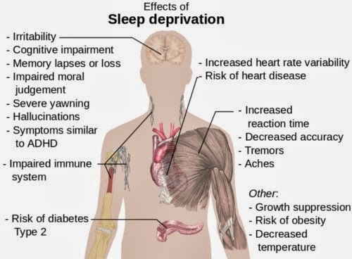 akibat kurang tidur bagi kesehatan