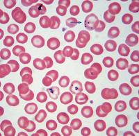 Howell jolly bodies vs Heinz body