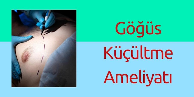 Göğüs Küçültme Ameliyatı