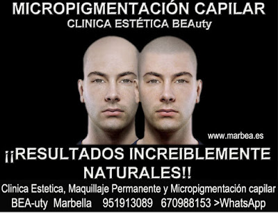 micropigmentación capilar Madrid Clínica Estética y tratamiento caida del cabello mujeres Madrid: Te ofrecemos la mayor calidad de servicios 