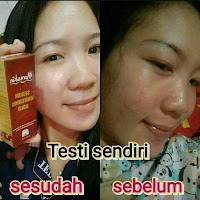 Jual Moreskin Serum Gold