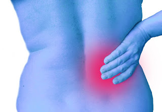 Common Causes of Back Pain