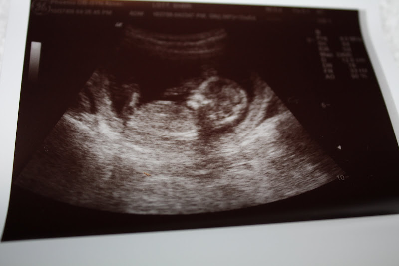 12 5 week ultrasound. 13 week ultrasound!