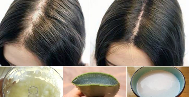 Apply This Natural Treatment To Your Hair And They Will Not Stop Pushing!