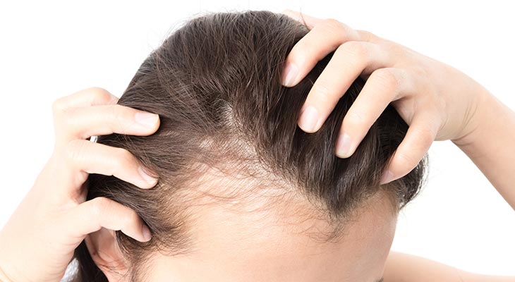 Hair Loss Treatment In Thane West