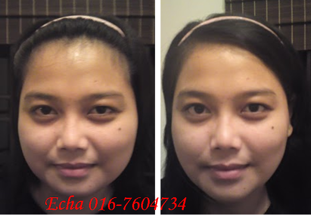 Cantik,Sihat,Anggun : Bio Ever Nano Cream