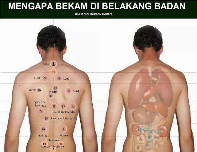 MAKLUMAT KESIHATAN DAN PENYAKIT: TITIK BEKAM